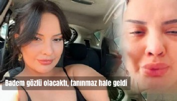 Badem gözlü olacaktı, tanınmaz hale geldi