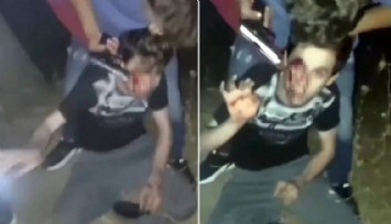 Suriyelilerden engelli Türk gencine öldüresiye dayak