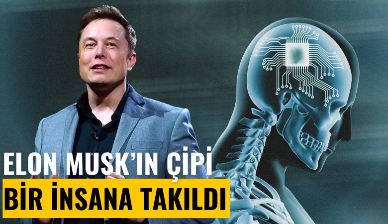 Elon Musk'ın çipi bir insana takıldı