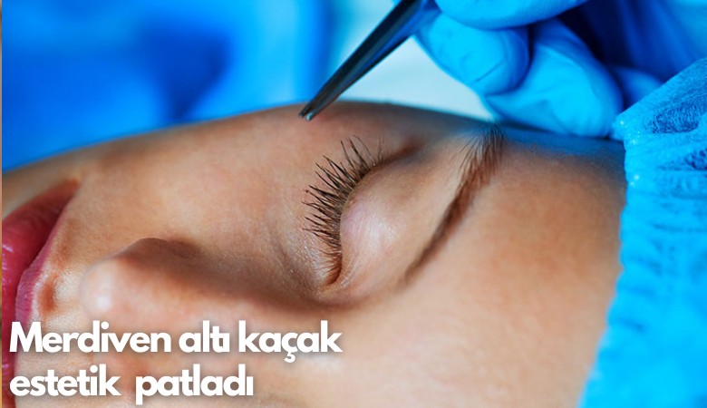 Merdiven altı kaçak estetik  patladı