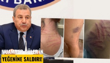 Muammer Güler'in yeğenine güzellik merkezinde saldırı!