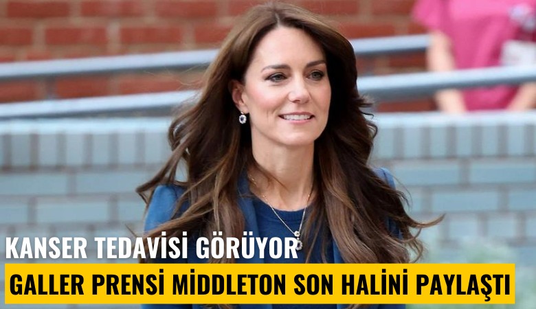 Kanser tedavisi görüyor: Galler Prensi Middleton son halini paylaştı