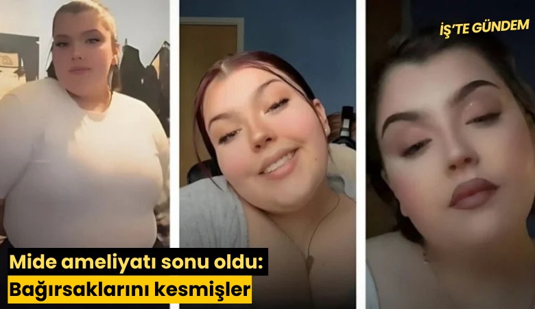 Mide ameliyatı sonu oldu: Bağırsaklarını kesmişler