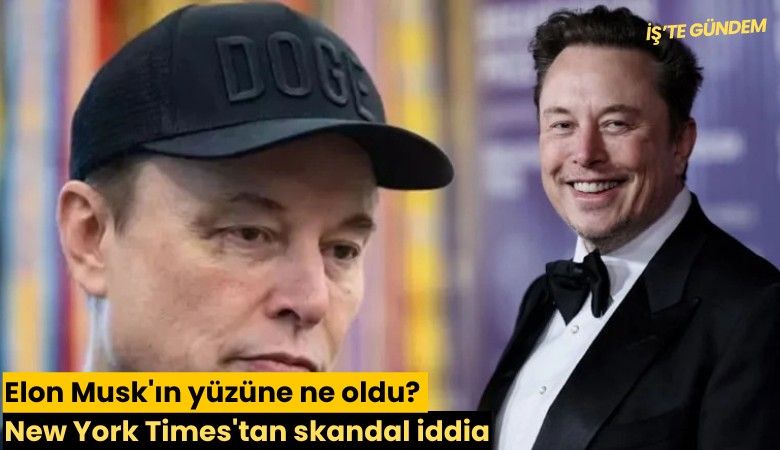 Elon Musk'ın yüzüne ne oldu? New York Times'tan skandal iddia