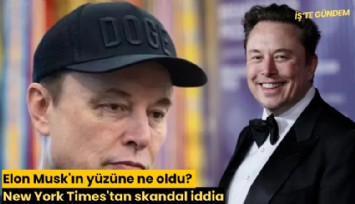Elon Musk'ın yüzüne ne oldu? New York Times'tan skandal iddia