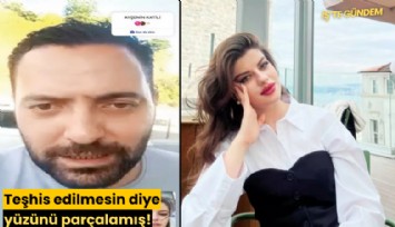 Teşhis edilmesin diye yüzünü parçalamış!