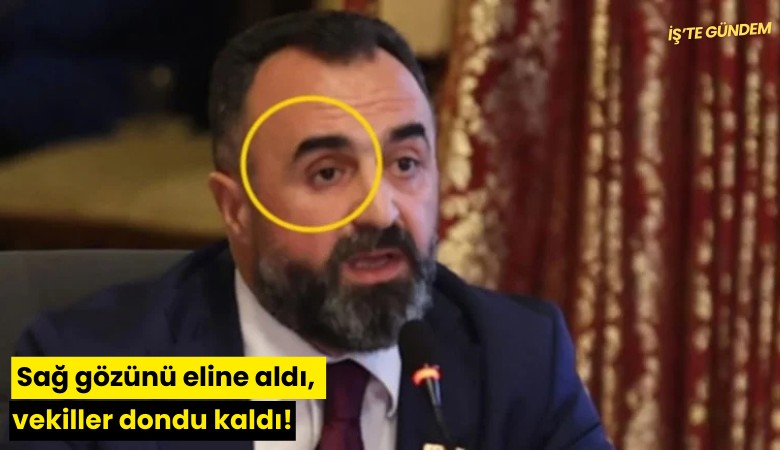 Sağ gözünü eline aldı, vekiller dondu kaldı!